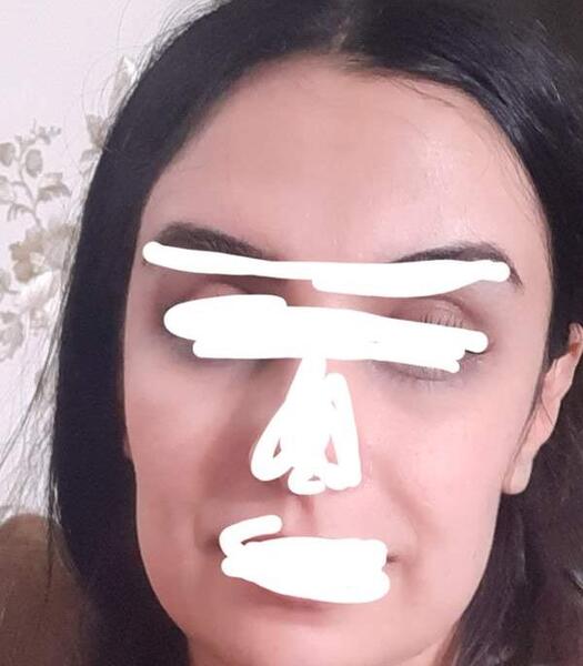کج افتادن صورت در عکس نی نی سایت