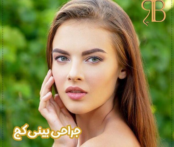 کج افتادن صورت در عکس نی نی سایت