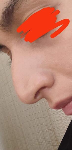 کج افتادن صورت در عکس نی نی سایت