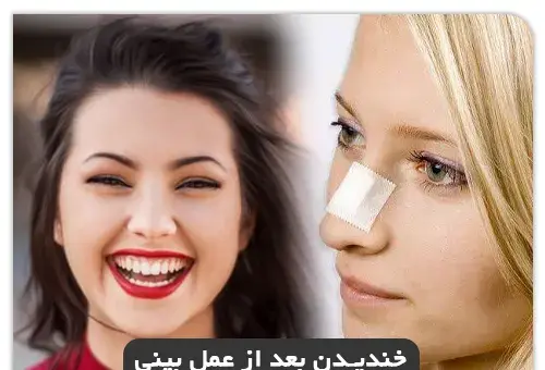 کج افتادن صورت در عکس نی نی سایت