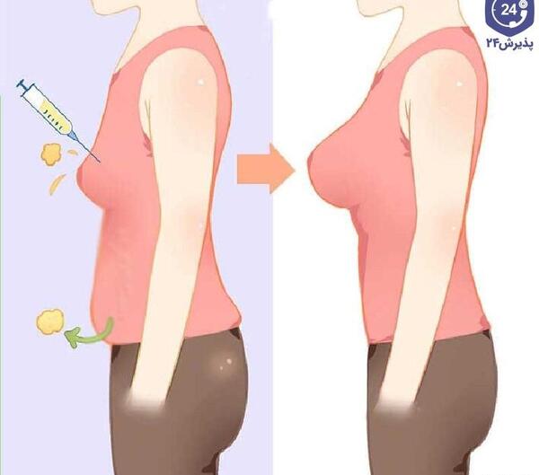 عکس شکم چاق نی نی سایت