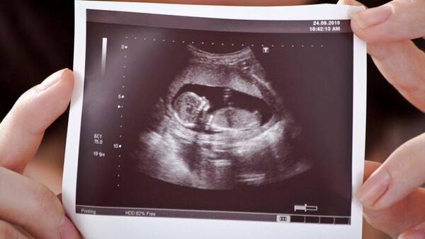 عکس شکمتون در بارداری نی نی سایت