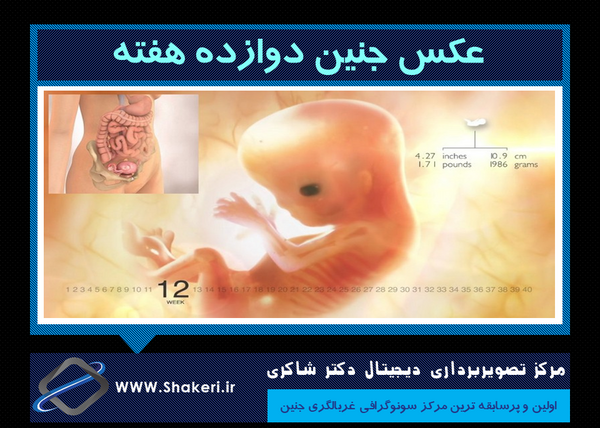 عکس سونوگرافی nt و تعیین جنسیت نی نی سایت