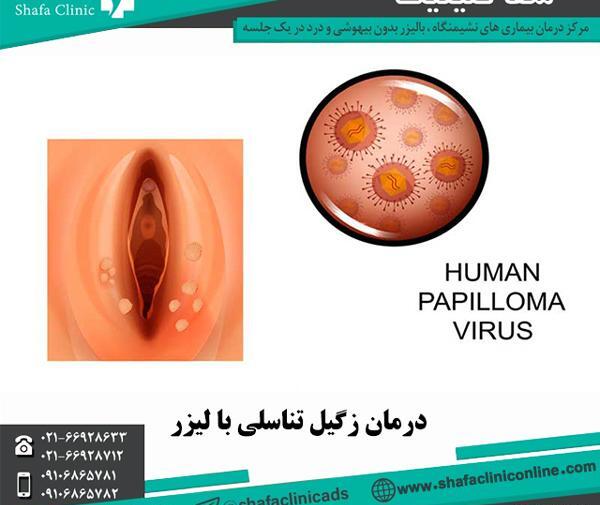 عکس زگیل مقعدی زنان نی نی سایت