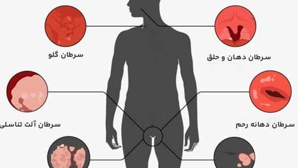 عکس زگیل مقعدی زنان نی نی سایت
