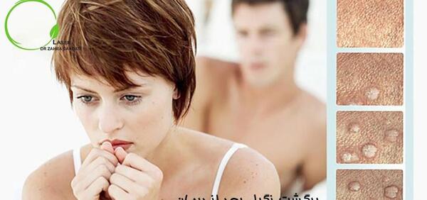 عکس زگیل مقعدی زنان نی نی سایت