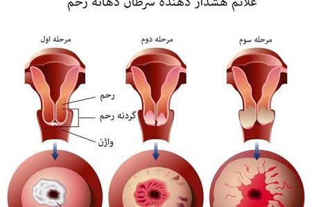 عکس زگیل مقعدی زنان نی نی سایت