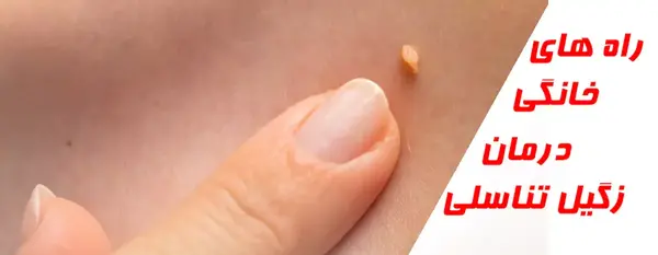 عکس زگیل دهانی نی نی سایت