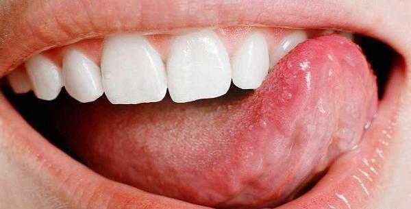 عکس زگیل دهانی نی نی سایت