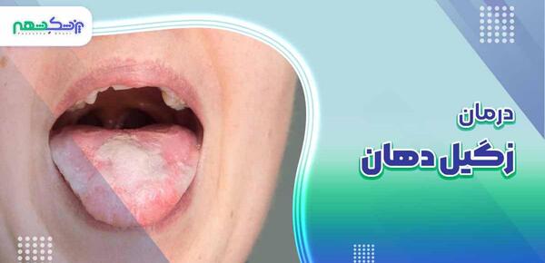 عکس زگیل دهانی نی نی سایت