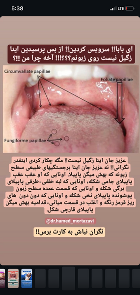 عکس زگیل دهانی نی نی سایت