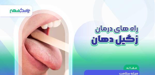 عکس زگیل دهانی نی نی سایت