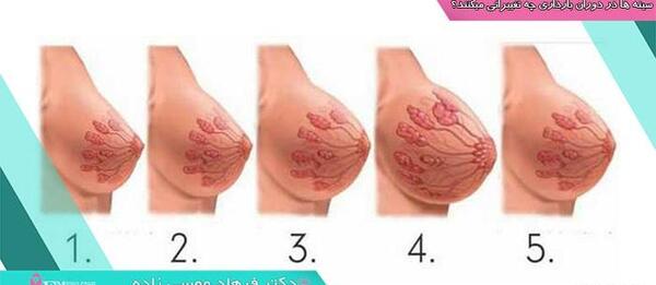 عکس زگيل روي سينه در بارداري نی نی سایت