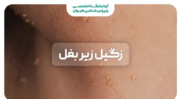 عکس زگيل روي سينه در بارداري نی نی سایت
