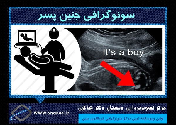 عکس رادیولوژی در بارداری نی نی سایت