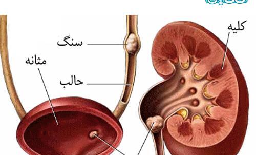 عکس رنگی کلیه درد داره نی نی سایت