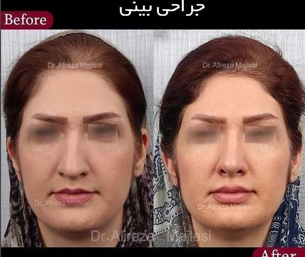 عکس از دماغتون نی نی سایت