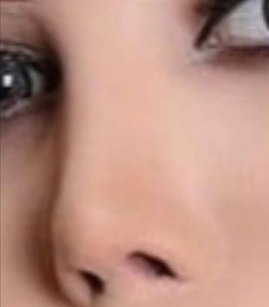 عکس از دماغتون نی نی سایت
