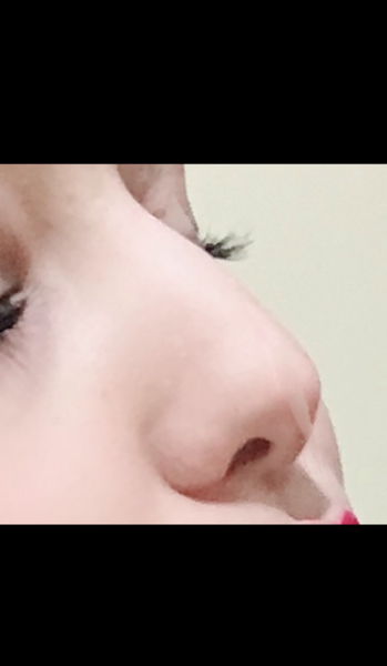عکس از دماغتون نی نی سایت