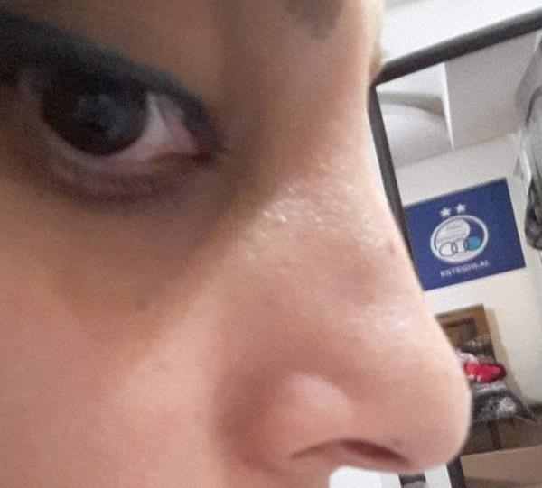 عکس از دماغتون نی نی سایت