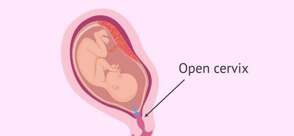 حاملگی بعد از عکس رنگی نی نی سایت
