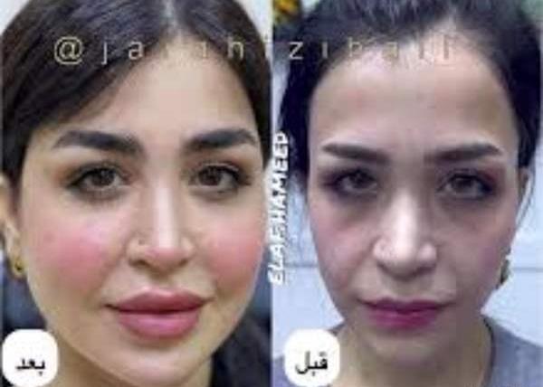 چهره مینیاتوری عکس یه دختر خوشگل نی نی سایت