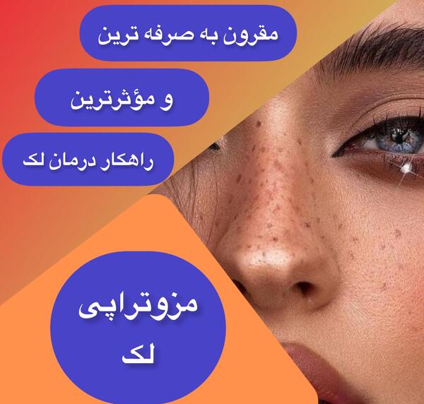 عکس از چشم نی نی سایت