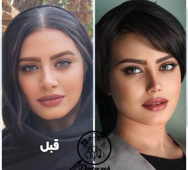 عکس از چشم نی نی سایت