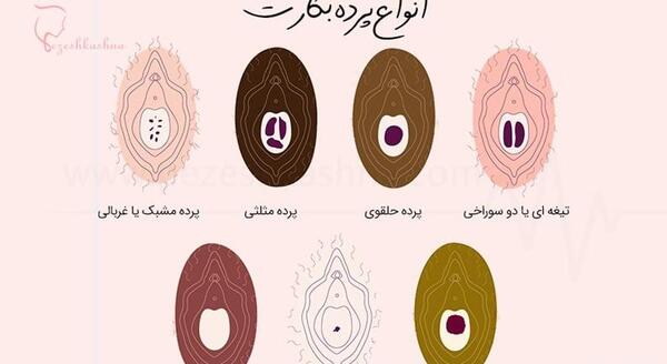 عکس از چشم نی نی سایت