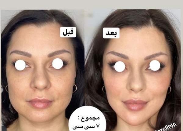ترس از پخش شدن عکس نی نی سایت