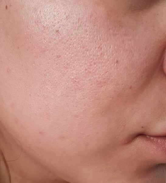 عکس از پوستتون نی نی سایت