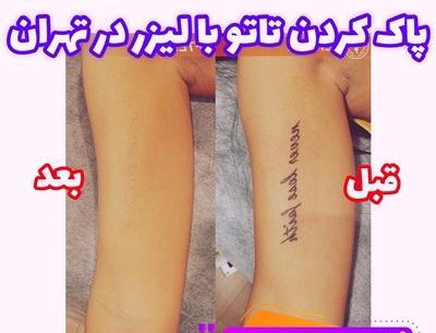 عکس از پوستتون نی نی سایت