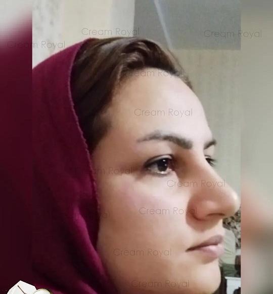 عکس از پوستتون نی نی سایت