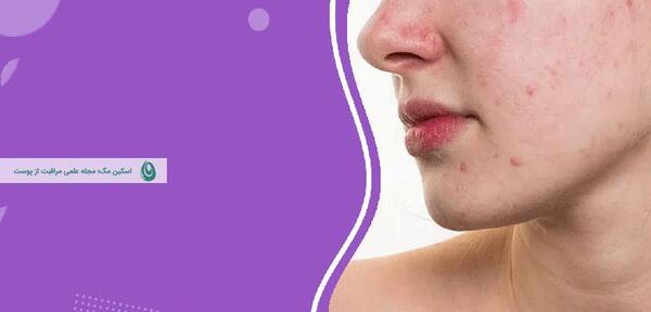 عکس از پوستتون نی نی سایت