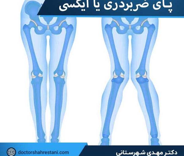 عکس ساق پاهاتون نی نی سایت