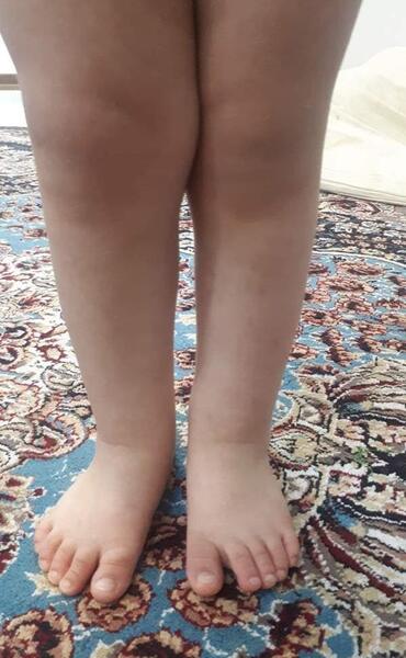عکس ساق پاهاتون نی نی سایت