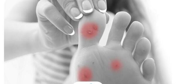 عکس میخچه پا نی نی سایت