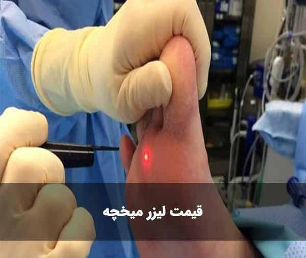 عکس میخچه پا نی نی سایت