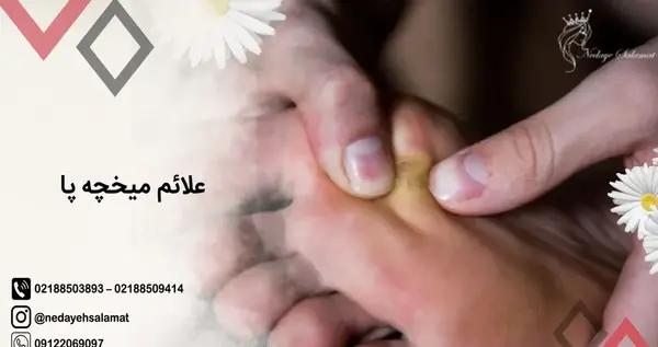 عکس میخچه پا نی نی سایت