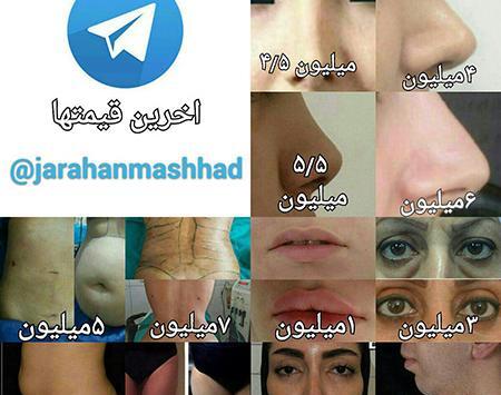 عکس عمل بینی گوشتی نی نی سایت