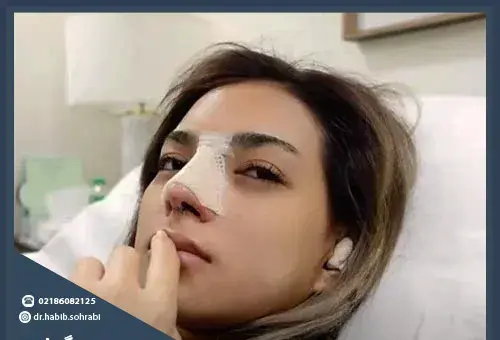 عکس عمل بینی گوشتی نی نی سایت