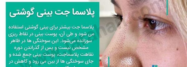 عکس عمل بینی گوشتی نی نی سایت
