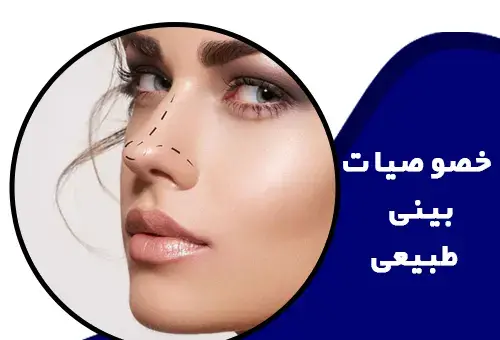 عکس بلافاصله بعد از عمل بینی نی نی سایت