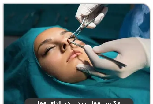 عکس بلافاصله بعد از عمل بینی نی نی سایت