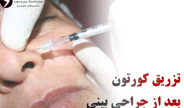 عکس قبل و بعد تزریق کورتون به بینی نی نی سایت