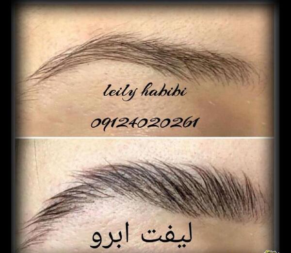 عکس لیفت ابرو نی نی سایت