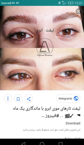 عکس لیفت ابرو نی نی سایت