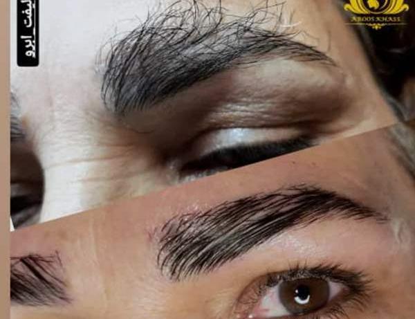 عکس لیفت ابرو نی نی سایت