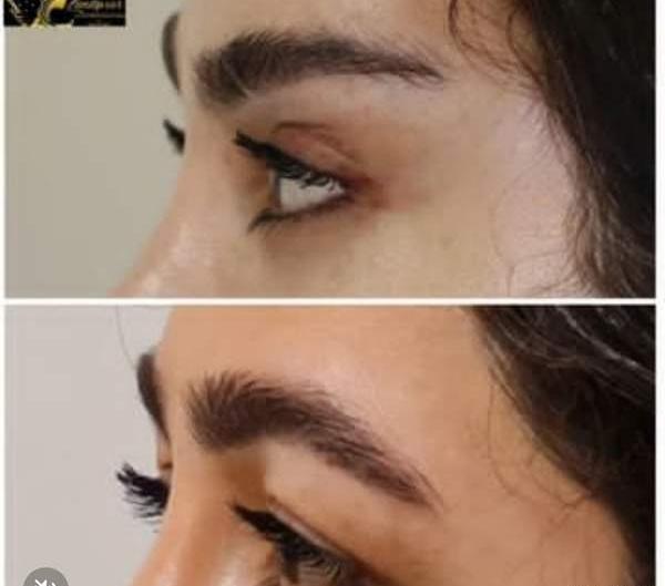 عکس لیفت ابرو نی نی سایت