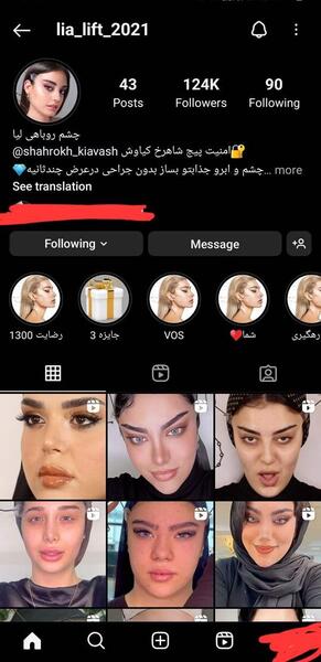 عکس لیفت ابرو نی نی سایت